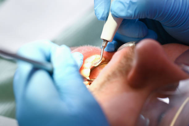 Best Broken or Cracked Tooth Emergency Dentist in Port Lavaca, TX