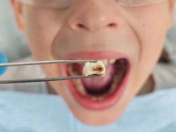 Best Mobile Emergency Dentist in Port Lavaca, TX